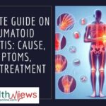 Rheumatoid Arthritis: Cause, Symptoms & Treatment