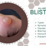 blisters