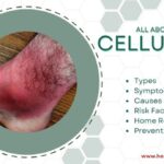 Cellulitis