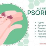 Psoriasis