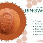 RINGWORM