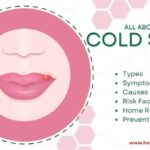 cold sore