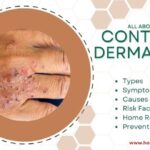Contact dermatitis