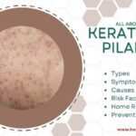 Keratosis pilaris