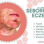 Seborrheic eczema
