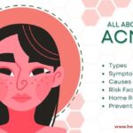 all about acne
