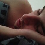 Obstructive Sleep Apnea