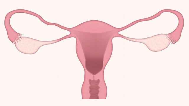 uterine cancer 