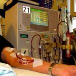 what-is-dialysis-types-process-benefits