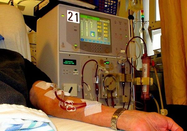 what-is-dialysis-types-process-benefits