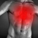 Gastroesophageal Reflux
