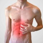 Gastroesophageal Reflux Disease (GERD)