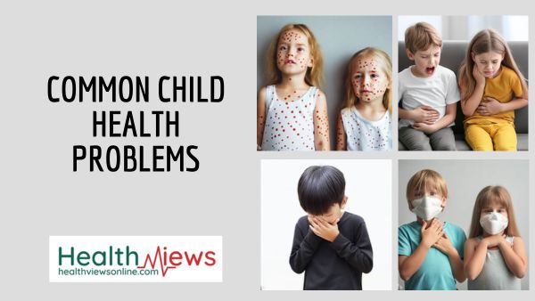 common child health problems