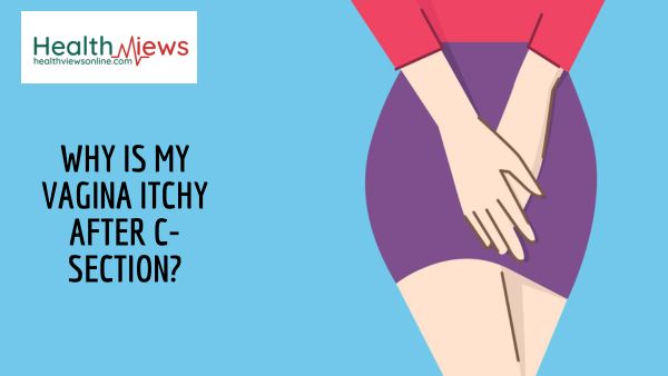 Why is my Vagina Itchy After C-Section?