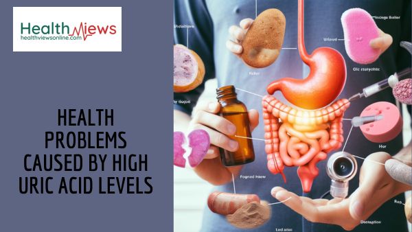 Health Problems Caused by High Uric Acid Levels