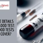 Complete Details on BMP Blood Test: What Blood Tests Does It Cover?