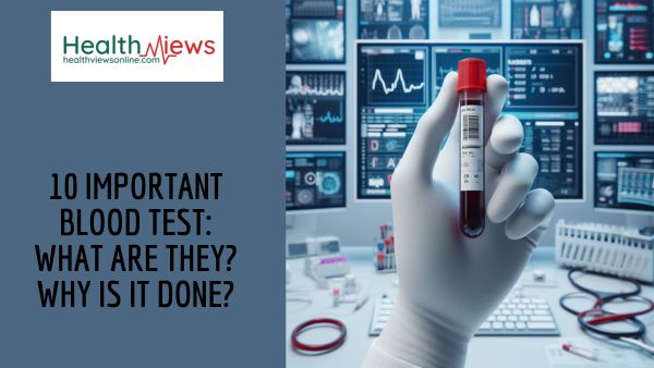 10 Important Blood Test: What are They? Why Is it Done?