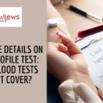 Lipid Profile Test