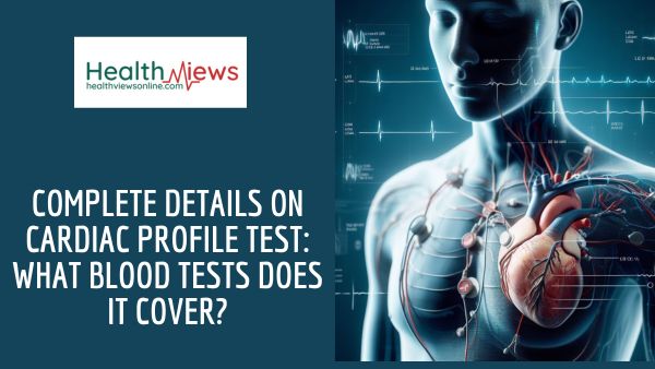 Complete Details on Cardiac Profile Test: What Blood Tests Does It Cover?