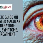 Complete Guide on Age-Related Macular Degeneration