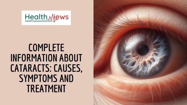 Complete Information about Cataracts: Causes, Symptoms and Treatment