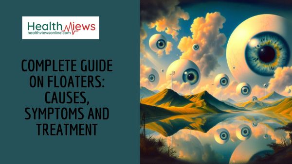 Complete Guide on Floaters