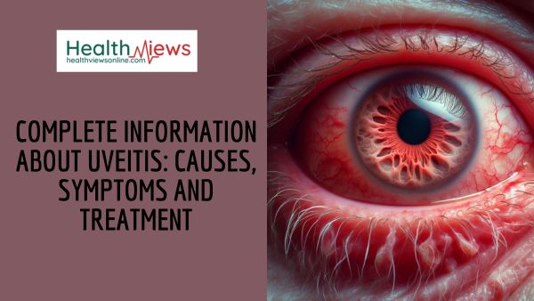 Complete Information about Uveitis: Causes, Symptoms and Treatment