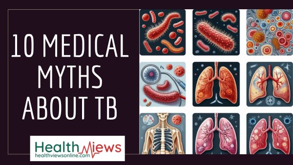 MEDICAL MYTHS ABOUT TB