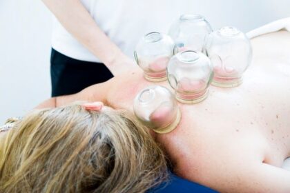 Know Now 10 Best Ways to Search Best Cupping Therapy in Your City