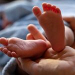 Now Know All about Clubfoot