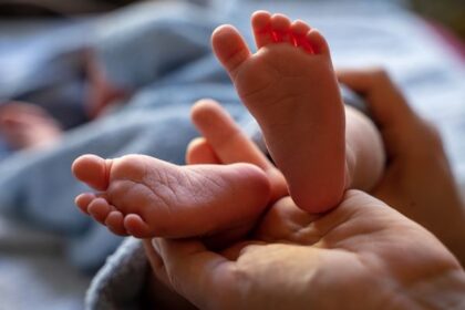 Now Know All about Clubfoot