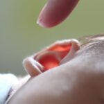 Now Know All about Congenital Hearing Loss: Cause, Symptoms, Diagnosis, Treatment