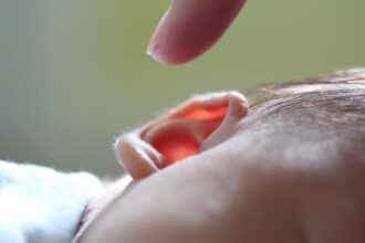 Now Know All about Congenital Hearing Loss: Cause, Symptoms, Diagnosis, Treatment