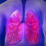 Now Know All about Cystic Fibrosis