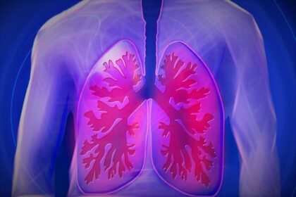 Now Know All about Cystic Fibrosis