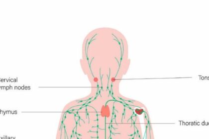 Lymphatic system diagram showing key areas affected by Hodgkin lymphoma