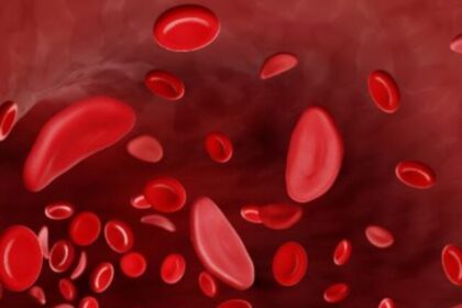 Sickle Cell Disease