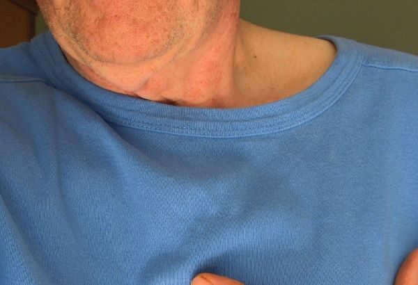 Understanding the Gender Differences Now in Heart Disease: Men vs. Women