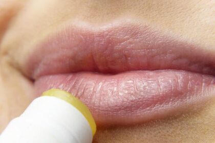 Try a 30-Day Lip Care Routine to Avoid Winter Chapping