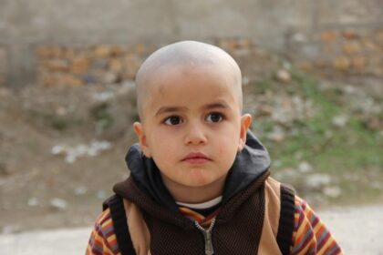 Proton beam therapy in india - cancer care